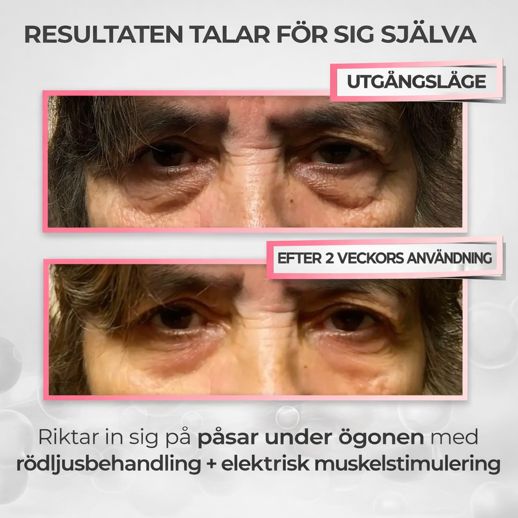 HealSkin™ - För dig som är trött på att se trött ut