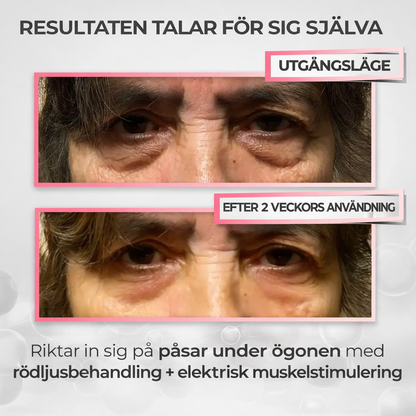 HealSkin™ - För dig som är trött på att se trött ut