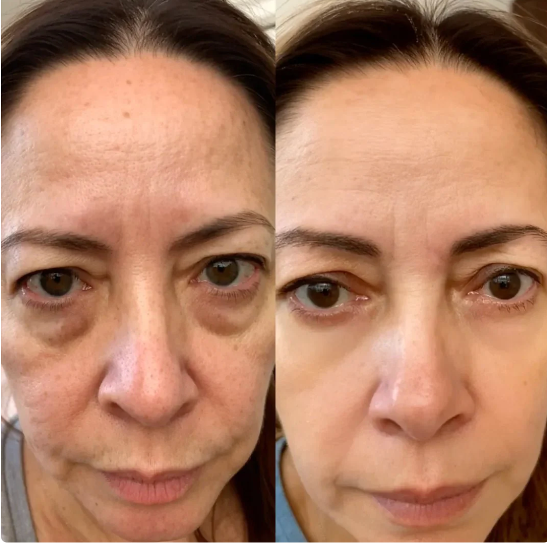 HealSkin™ - För dig som är trött på att se trött ut