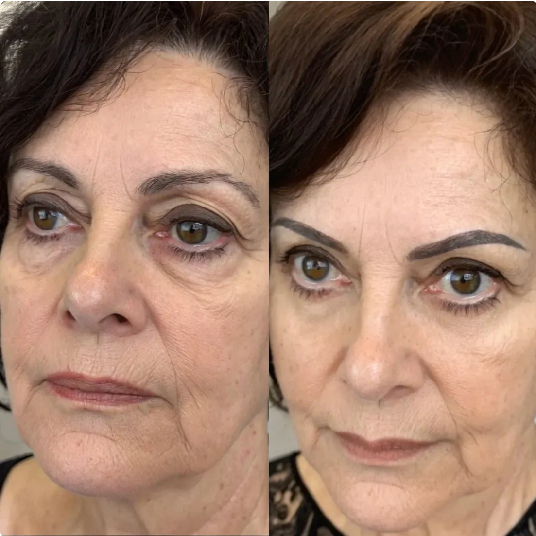 HealSkin™ - För dig som är trött på att se trött ut